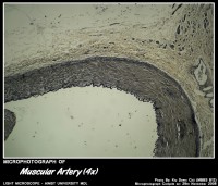Micro-photograph of Muscular Artery under Light Microscope magnification 4x